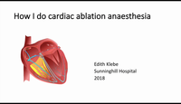How I do cardiac ablation anaesthesia...