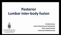 Posterior lumbar inter-body fusion...