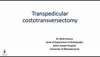 Transpedicular costotransversectomy...