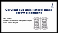 Cervical Sub-axial lateral mass screw placement...
