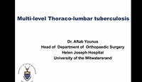 Multi-level Thoraco-lumbar tuberculosis...