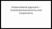 Posterolateral approach - costotranseversectomy and corpectomy T Spine...