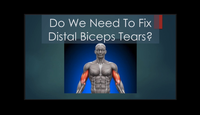 Do we need to fix distal biceps tears...