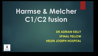 Harmse and Melcher C1/C2 techniques...