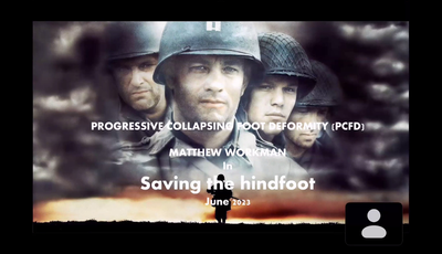 SAVING THE HINDFOOT: Progressive Collapsing Foot Deformity...