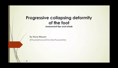 Assessment Tips and Rehab of Progressive Collapsing Foot Deformity...