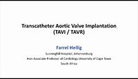 Transcatheter Aortic Valve Imp...