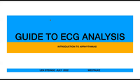 Guide to ECG Analysis...