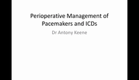 Perioperative management of pacemakers and ICDs...