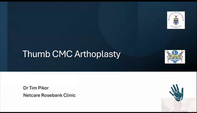 Arthroplasty of the Thumb CMC ...