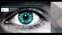 Update on laser and surgical t...