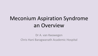 Meconium aspiration syndrome...