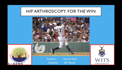 The Pros of Hip Arthroscopy...