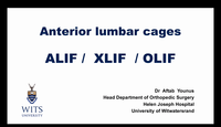 Anterior lumbar cages: ALIF, X...