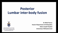 Posterior lumbar inter-body fu...