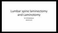 Lumbar spine laminectomy and l...