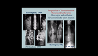 Progression of instrumentation...