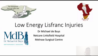 Low Energy Lisfranc injuries...