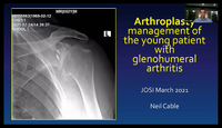 Arthroplasty Management of Sho...