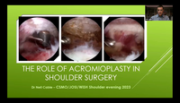 The Role of Acromioplasty in Shoulder Surgery...
