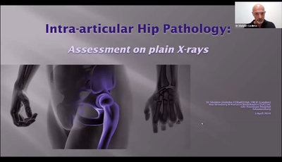 Intra-articular Hip Pathology: Assessment on plain...
