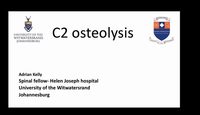 A case of unexplained C2 osteo...