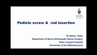 Pedicle screw and rod insertion...