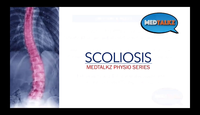 Q and A SCOLIOSIS WEBINAR...