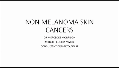 Non melanoma skin cancer...