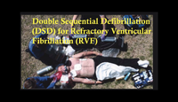 Double sequential defibrillati...