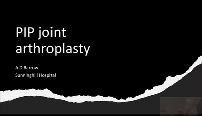 PIP joint replacement...