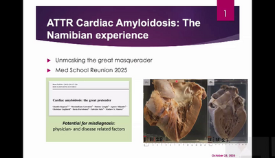 ATT cardiac amyloid...