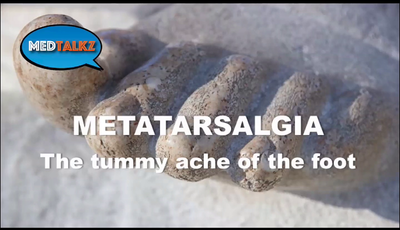 Q and A - Metatarsalgia...