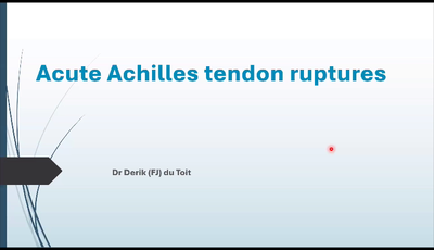 Acute Achilles Tendon Rupture...