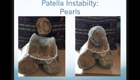 Patella instability: Pearls...
