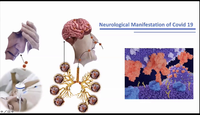 Neurological Manifestations of...